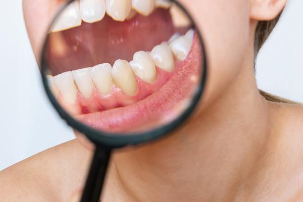 치아보험 교정 시술도 적용될지 치아보험비교사이트 통해서 실속보장치아보험 체크하기